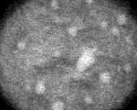 Nanodiamonds Are Forever