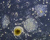 Can hair-growing stem cells cure baldness?
