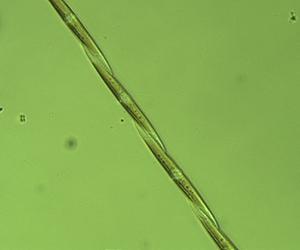 Iron Stimulates Blooms Of Toxin-Producing Algae In Open Ocean