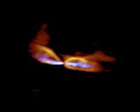 ALMA differentiates two birth cries from a single star