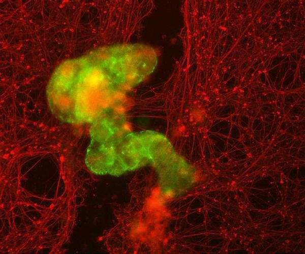 Scientists build tiny biological robots from human cells
