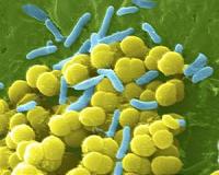 New method to determine antibiotic resistance fast