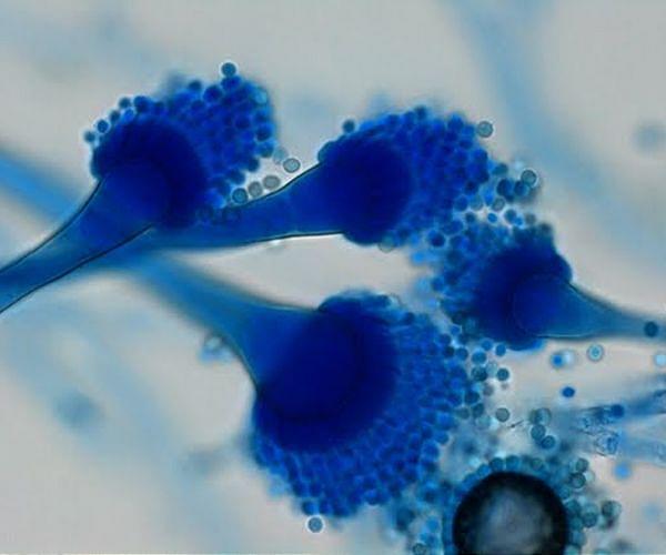 Can music help plants grow? Study suggests sound boosts fungus