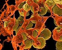 Superbugs could kill 'more than cancer' by 2050