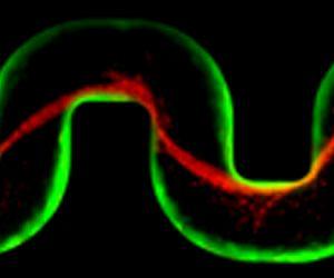 How do bacteria clog medical devices? Very quickly