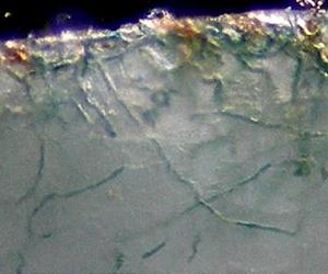Mystery Dissolves With Calcium Pump Discovery