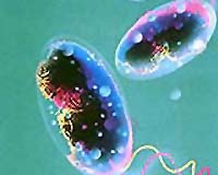 Cholera epidemic kills 200 in Guinea-Bissau: UN agencies