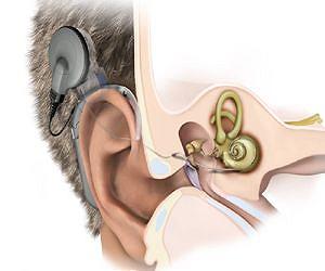 Understanding hearing