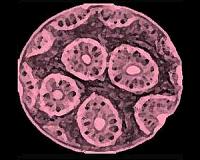 Cancer often due to bad luck, not genes or environment
