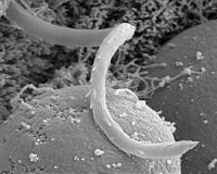 Lethal parasite evolved from pond scum