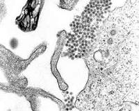 Dengue cases soar in Brazil, as death toll climbs