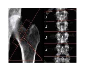 Doctor claims breakthrough in race for spinal 'cure'