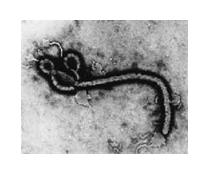 Air transmission of Ebola virus a concern