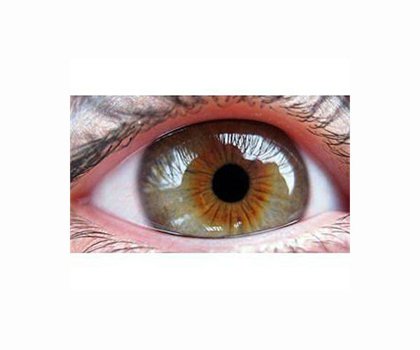 Polaris Dawn team collaborates with MCG physicians to investigate vision loss in space