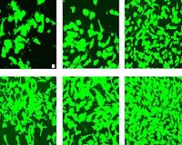 Nanotextured Implant Materials: Blending in, Not Fighting Back