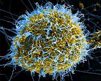 West Africa counts economic cost as Ebola outbreak ends
