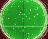 Scientists report big improvements in HIV vaccine production