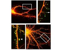 Insight into how brain makes memories