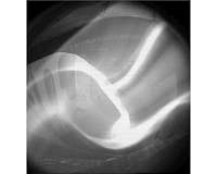 Successful second round of experiments with Wendelstein 7-X