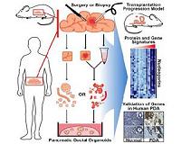 3-D culture system for pancreatic cancer could change therapeutic approaches