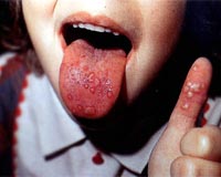 China calls for vigilance in disease outbreak: state media