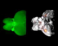 Watching the brain in action