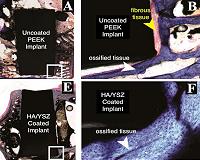 Bioactive film improves how implants bond with bone in animal study