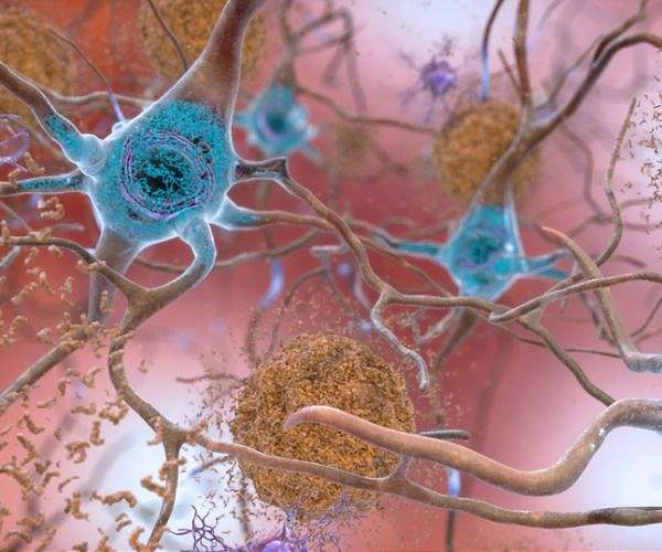 Atomic-level study of brain protein opens door to new neurological treatments