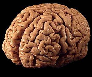 Nanoparticles reboot blood flow in brain