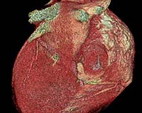 NASA Image Fusion Will Help Doctors Examine Astronauts' Hearts In Space