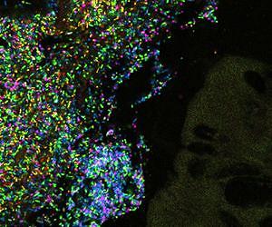 The Rare Biosphere of the Human Body