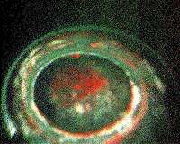 Jupiters complex transient auroras