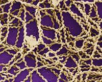 A 'warhead' molecule to hunt down deadly bacteria