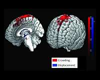 Study underscores changes in brain structure, function in long-duration space missions