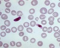 Chemists help develop a novel drug to fight malaria