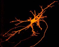 West Nile Virus Spread Through Nerve Cells Linked To Serious Complication