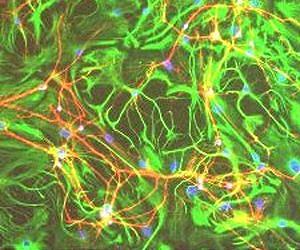 Brain's Connective Cells Are Much More Than Glue