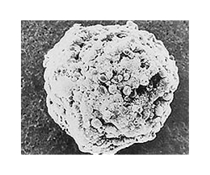 Smart Nanoparticles Could Identify, Target And Kill Cancer Cells