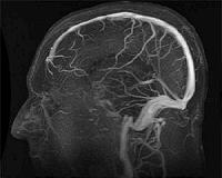Large increase seen in emergency department visits for traumatic brain injury
