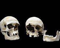 Plague first came to Europe during the Stone Age