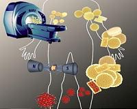 Nanoscale composites improve MRI