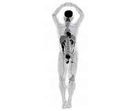 Human images from world's first total-body scanner unveiled