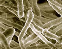 Lean And Mean Biomass-Degrading Fungus Reveals Capabilities For Improved Biofuel Production