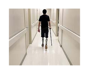 Amputee creates LEGO prosthetic