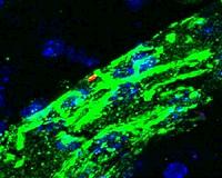 Bubonic bottleneck: UNC scientists overturn dogma on the plague