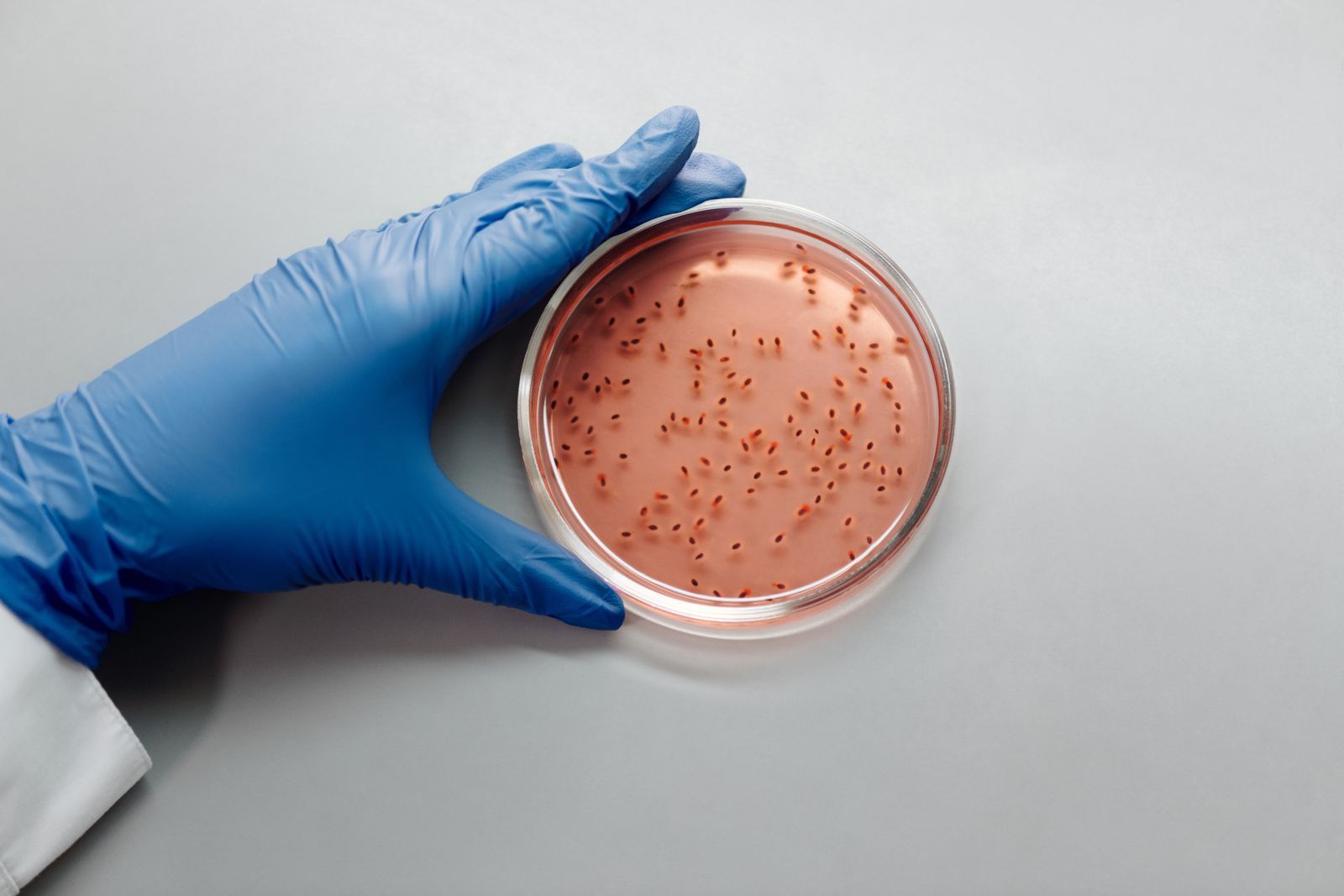 In 1928, Alexander Fleming came back from a two-week holiday to find a stray mould contaminating a stack of Staphylococcus plates in his St Mary's lab, and the clear ring of dead bacteria around the fungus became the accidental start of the antibiotic era