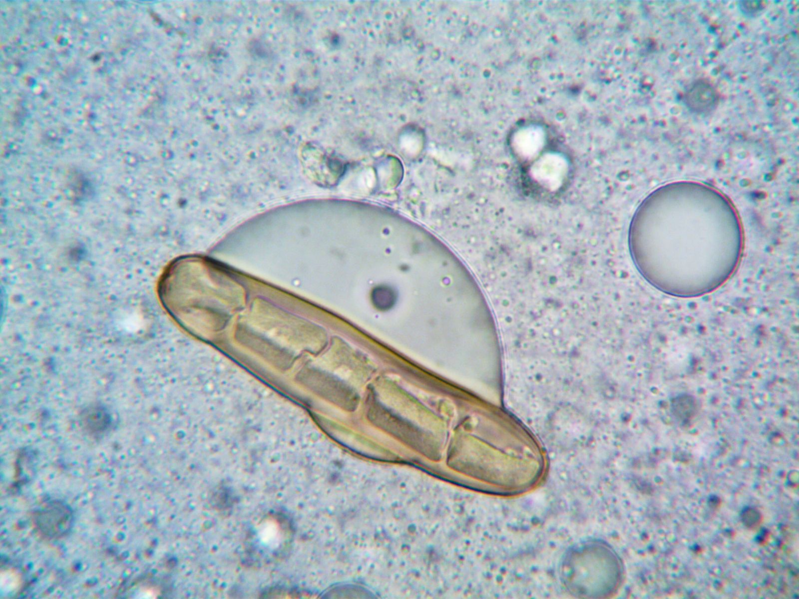Tardigrades pulled from Antarctic moss can survive a decade without water, temperatures near absolute zero, and a 10-day exposure to the open vacuum of space in 2007, curling into a dehydrated husk they call a tun until conditions improve